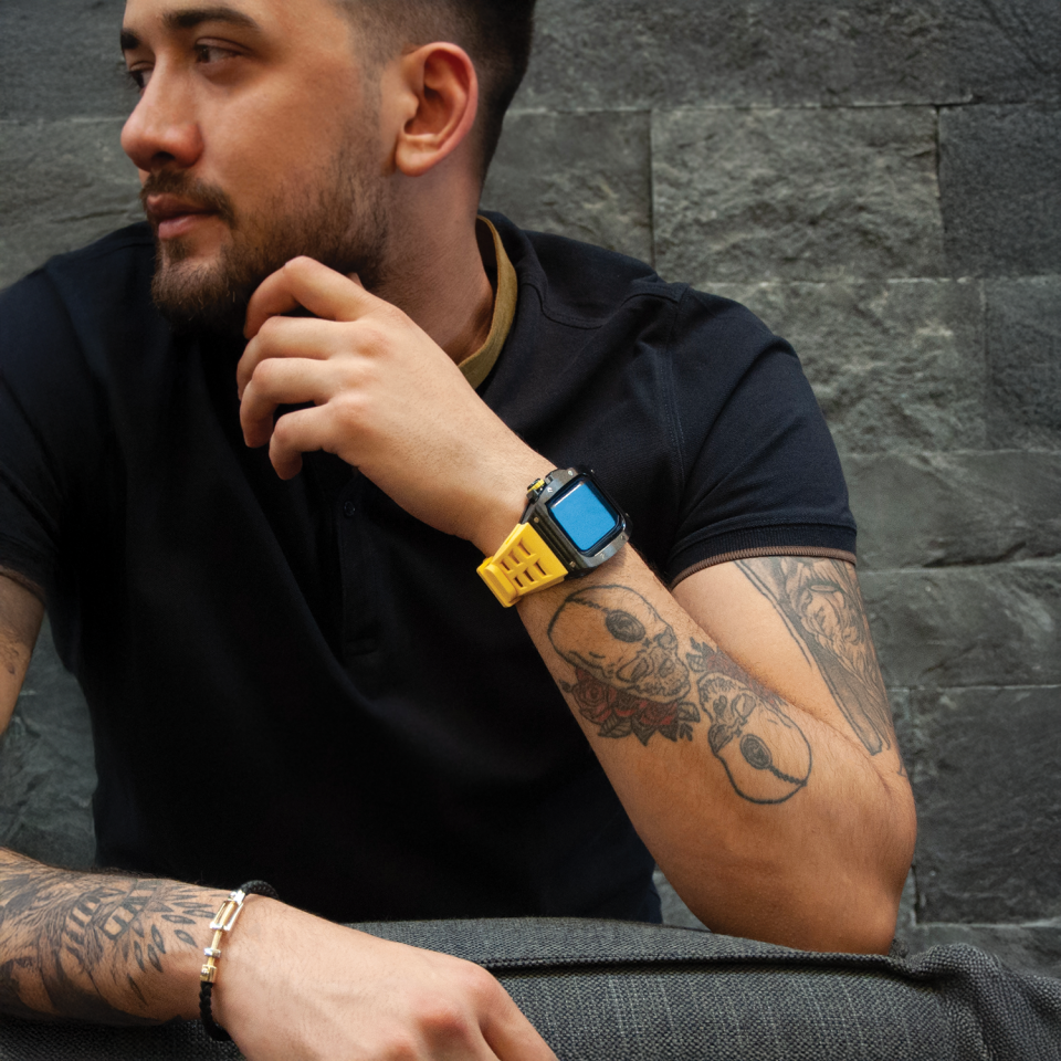 GIALLO APPLE WATCH KILIF